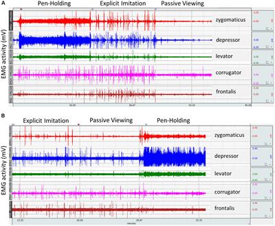 Incongruence Between Observers’ and Observed <mark class="highlighted">Facial Muscle</mark> Activation Reduces Recognition of Emotional Facial Expressions From Video Stimuli